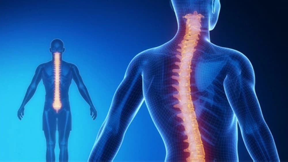 الجنف: انحناءة تغير الحياة وجهود المملكة الرائدة في العلاج